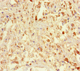 Immunohistochemistry (Formalin/PFA-fixed paraffin-embedded sections) - Anti-IFT46 antibody (AB223036), expandable thumbnail