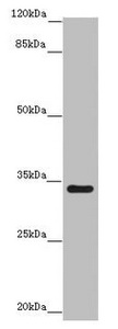 Western blot - Anti-IFT46 antibody (AB223036), expandable thumbnail