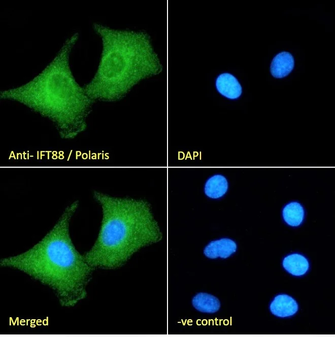 Immunocytochemistry/ Immunofluorescence - Anti-IFT88 antibody (AB42497)