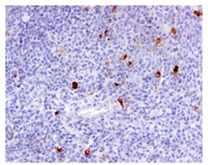 Immunohistochemistry (Formalin/PFA-fixed paraffin-embedded sections) - Anti-IgA antibody [EPR5367-76] (AB124716), expandable thumbnail