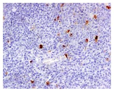 Immunohistochemistry (Formalin/PFA-fixed paraffin-embedded sections) - Anti-IgA antibody [EPR5367-76] (AB124716)