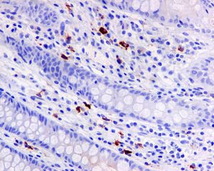 Immunohistochemistry (Formalin/PFA-fixed paraffin-embedded sections) - Anti-IgA antibody [EPR5367-76] (AB124716), expandable thumbnail