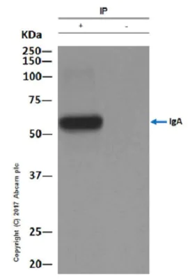 Immunoprecipitation - Anti-IgA antibody [EPR5367-76] (AB124716)