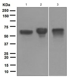 Western blot - Anti-IgA antibody [EPR5367-76] (AB124716), expandable thumbnail