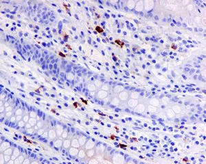 Immunohistochemistry (Formalin/PFA-fixed paraffin-embedded sections) - Anti-IgA antibody [EPR5367-76] - BSA and Azide free (AB214003)