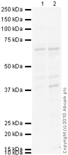 Western blot - Anti-IgA Secretory Component antibody [SC-05] (AB3924), expandable thumbnail