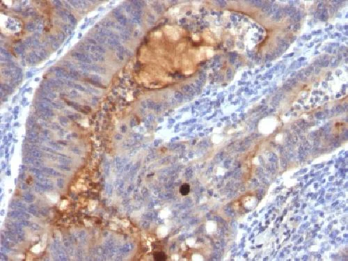 Immunohistochemistry (Formalin/PFA-fixed paraffin-embedded sections) - Anti-IgA Secretory Component antibody [SPM217] (AB17921)
