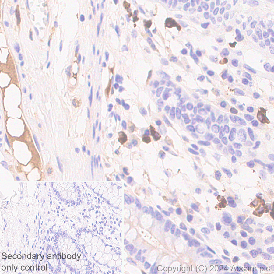 Immunohistochemistry (Formalin/PFA-fixed paraffin-embedded sections) - Anti-IgA1 antibody [EPR26775-27] (AB316187), expandable thumbnail