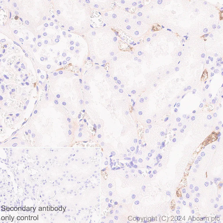 Immunohistochemistry (Formalin/PFA-fixed paraffin-embedded sections) - Anti-IgA1 antibody [EPR26775-27] - BSA and Azide free (AB316188)