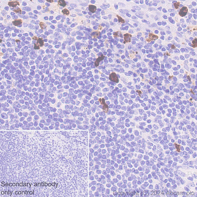 Immunohistochemistry (Formalin/PFA-fixed paraffin-embedded sections) - Anti-IgA1 antibody [EPR26775-27] - BSA and Azide free (AB316188)