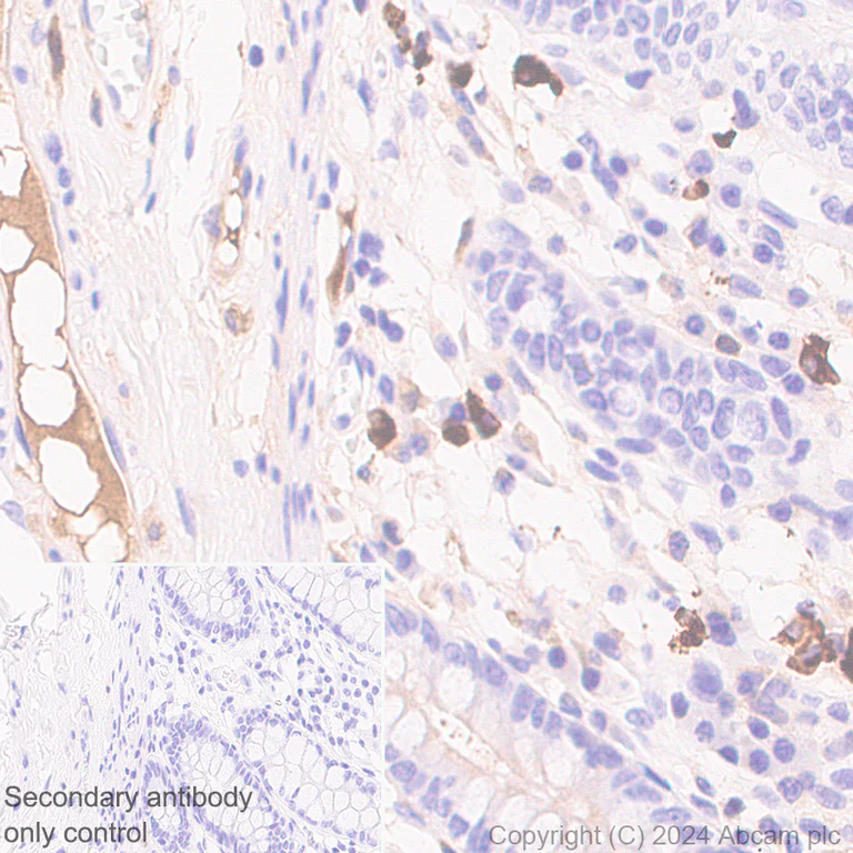 Immunohistochemistry (Formalin/PFA-fixed paraffin-embedded sections) - Anti-IgA1 antibody [EPR26775-27] - BSA and Azide free (AB316188)