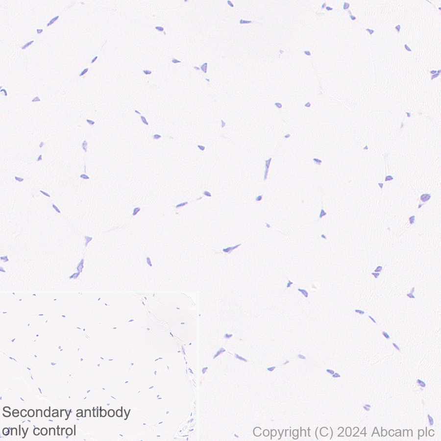 Immunohistochemistry (Formalin/PFA-fixed paraffin-embedded sections) - Anti-IgA1 antibody [EPR26775-27] - BSA and Azide free (AB316188), expandable thumbnail