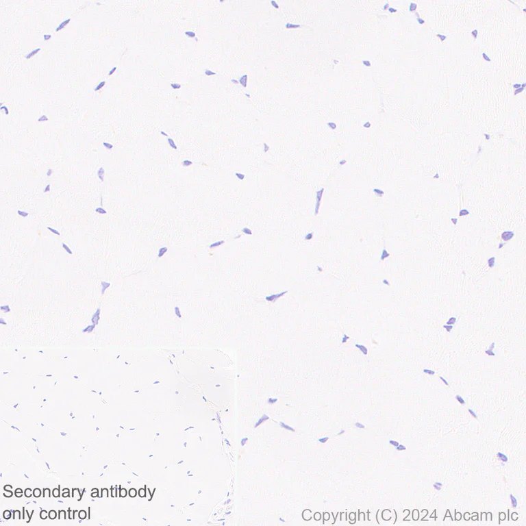 Immunohistochemistry (Formalin/PFA-fixed paraffin-embedded sections) - Anti-IgA1 antibody [EPR26775-27] - BSA and Azide free (AB316188)