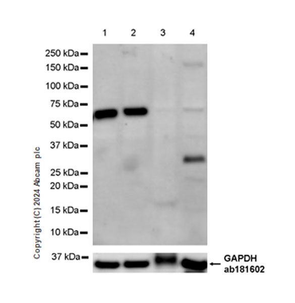 Western blot - Anti-IgA1 antibody [EPR26775-27] - BSA and Azide free (ab316188), expandable thumbnail