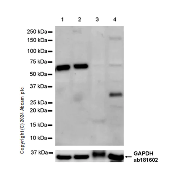 Western blot - Anti-IgA1 antibody [EPR26775-27] - BSA and Azide free (AB316188)