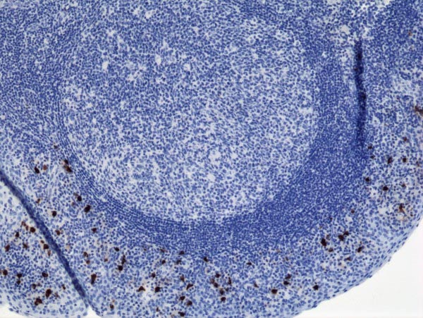 Immunohistochemistry (Formalin/PFA-fixed paraffin-embedded sections) - Anti-IgA2 antibody [RM125] (AB193169)