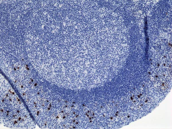 Immunohistochemistry (Formalin/PFA-fixed paraffin-embedded sections) - Anti-IgA2 antibody [RM125] (AB193169)