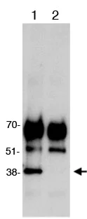 Immunoprecipitation - Anti-IGBP1 antibody (AB70545)