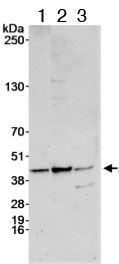 Western blot - Anti-IGBP1 antibody (AB70545), expandable thumbnail