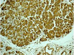 Immunohistochemistry paraffin embedded sections - Anti-IGBP1 antibody [EPR12315] (AB170911)