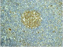 Immunohistochemistry paraffin embedded sections - Anti-IGBP1 antibody [EPR12315] (AB170911)
