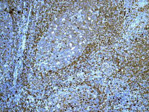 Immunohistochemistry (Formalin/PFA-fixed paraffin-embedded sections) - Anti-IgD antibody [EPR6146] (AB124795), expandable thumbnail