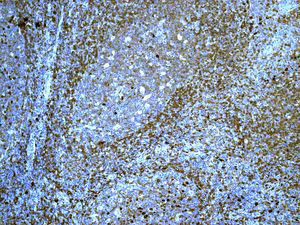 Immunohistochemistry (Formalin/PFA-fixed paraffin-embedded sections) - Anti-IgD antibody [EPR6146] (AB124795)