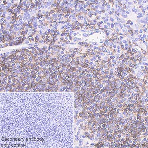 Immunohistochemistry (Formalin/PFA-fixed paraffin-embedded sections) - Anti-IgD antibody [EPR6146] (AB124795), expandable thumbnail