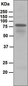 Western blot - Anti-IgD antibody [EPR6146] (AB124795), expandable thumbnail