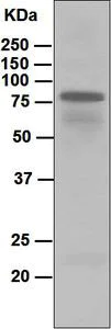 Western blot - Anti-IgD antibody [EPR6146] (AB124795)