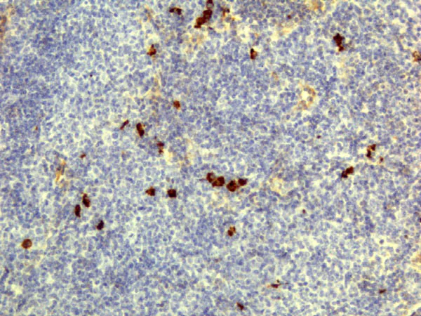 Immunohistochemistry (Formalin/PFA-fixed paraffin-embedded sections) - Anti-IgD antibody [RM123] (AB195581)