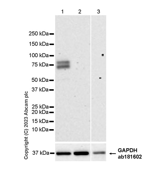 Western blot - Anti-IgE antibody [EPR26777-14] (AB309141), expandable thumbnail