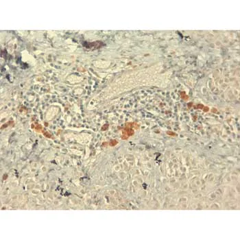 Immunohistochemistry (Formalin/PFA-fixed paraffin-embedded sections) - Anti-IGF1 antibody [7973] (AB176523)