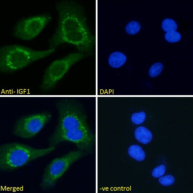 Immunocytochemistry - Anti-IGF1 antibody (AB106836), expandable thumbnail