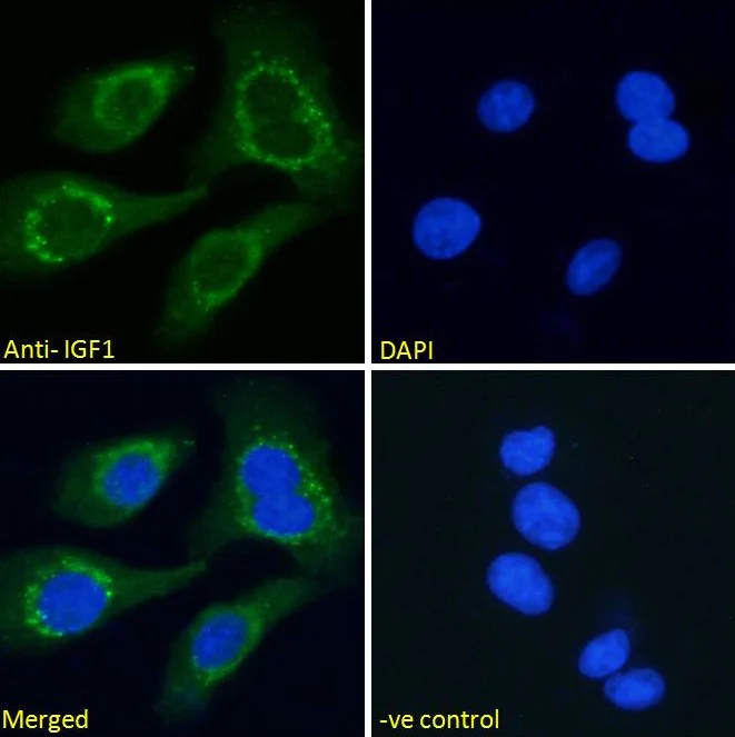 Immunocytochemistry - Anti-IGF1 antibody (AB106836)