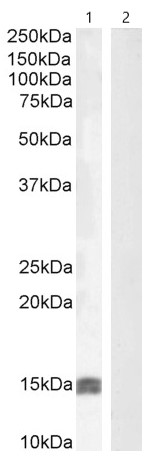 Western blot - Anti-IGF1 antibody (AB106836), expandable thumbnail
