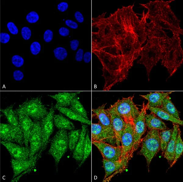 Immunocytochemistry/ Immunofluorescence - Anti-IGF1 antibody (AB223567)