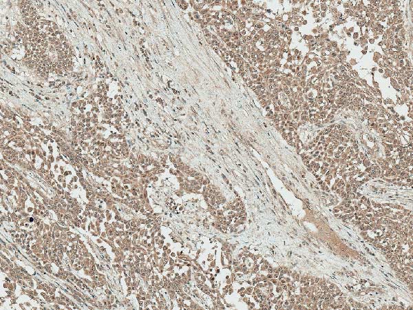 Immunohistochemistry (Formalin/PFA-fixed paraffin-embedded sections) - Anti-IGF1 antibody (AB223567), expandable thumbnail