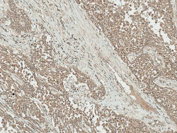 Immunohistochemistry (Formalin/PFA-fixed paraffin-embedded sections) - Anti-IGF1 antibody (AB223567)