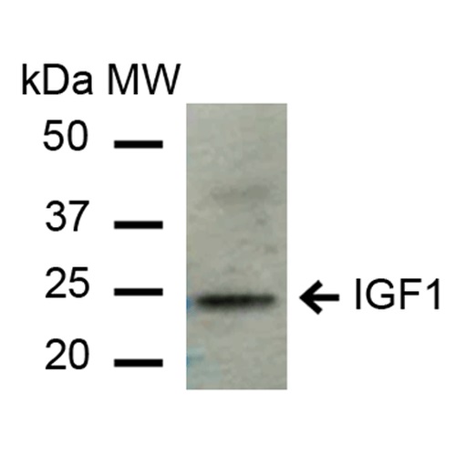 Western blot - Anti-IGF1 antibody (AB223567), expandable thumbnail