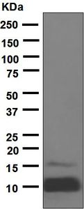 Western blot - Anti-IGF1 + IGF2 antibody [EPR5098(2)] (AB133542)