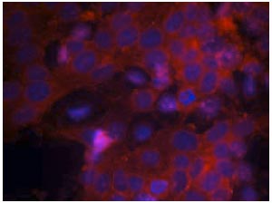 Immunocytochemistry/ Immunofluorescence - Anti-IGF1 Receptor antibody (AB131476), expandable thumbnail