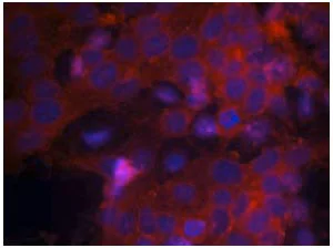 Immunocytochemistry/ Immunofluorescence - Anti-IGF1 Receptor antibody (AB131476)