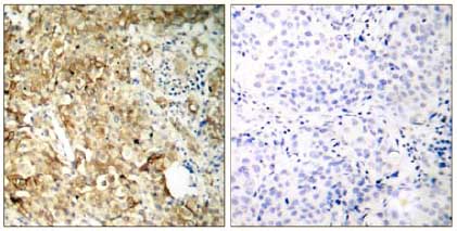 Immunohistochemistry (Formalin/PFA-fixed paraffin-embedded sections) - Anti-IGF1 Receptor antibody (AB131476), expandable thumbnail