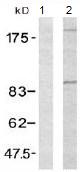 Western blot - Anti-IGF1 Receptor antibody (AB131476), expandable thumbnail