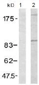 Western blot - Anti-IGF1 Receptor antibody (AB131476)