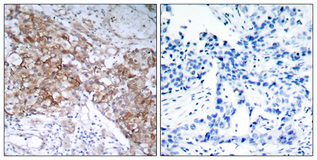 Immunohistochemistry (Formalin/PFA-fixed paraffin-embedded sections) - Anti-IGF1 Receptor antibody (AB39675)