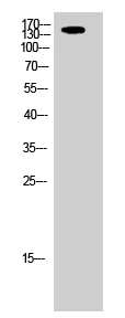 Western blot - Anti-IGF1 Receptor antibody (AB39675)
