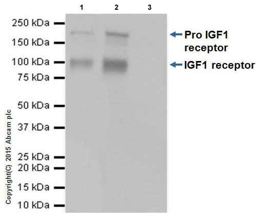 Immunoprecipitation - Anti-IGF1 Receptor antibody [EPR19322] (ab182408), expandable thumbnail