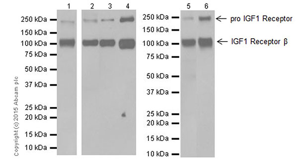 Western blot - Anti-IGF1 Receptor antibody [EPR19322] (AB182408), expandable thumbnail